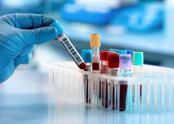 Habiten mjekët/ Një zonë në Lombardi pa koronavirus, banorëve u analizohet gjaku