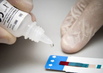 Jo vetëm koronavirusin/ Testi i gjakut mund të identifikojë “mbi 50 lloje të kancerit”