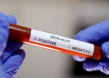 4 raste të reja të konfirmuara/ Shkon në 28 numri i personave me koronavirus në Kosovë