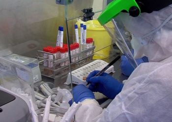 Rritet frikshëm numri i të prekurve nga koronavirusi në Maqedoninë e Veriut, 5 viktima në orët e fundit