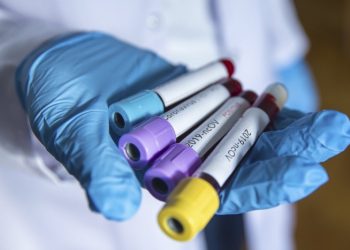 Shkoi në spital pas aksidentit, analizat e nxjerrin të infektuar me COVID-19. Vetëkarantinohen mjekët që i shërbyen