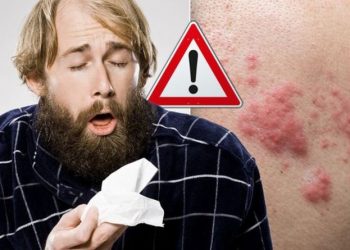 Keni këto pika të kuqe në lëkurën tuaj? Kujdes, është shenja e re e COVID-19