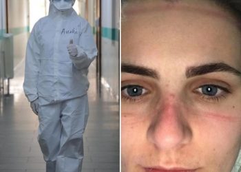 “Provë e sakrificës në përballjen me armikun e padukshëm”, Balla nxjerr fotot nga Infektivi dhe tregon çfarë ndodh aty