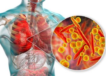 Mjeku pneumolog: Ja çfarë i bën trupit koronavirusi, pse mushkëritë janë më të rrezikuarat