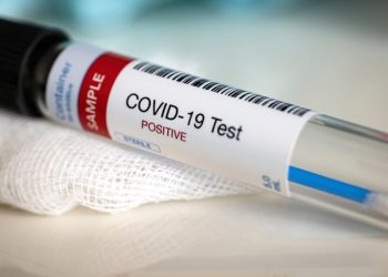 E gjithë familja rezulton pozitive me koronavirus, rritet numri i të infektuarve në Fier