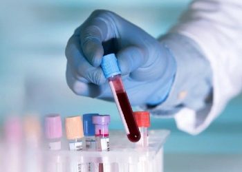 Të zbulosh me një pikë gjaku nëse je infektuar me Covid-19/ Francezët prodhojnë testin e shpejtë