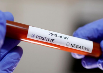 Shtohet numri i të prekurve me koronavirus në Shkodër/ Nga 15 teste, 12 të infektuar në dy familje
