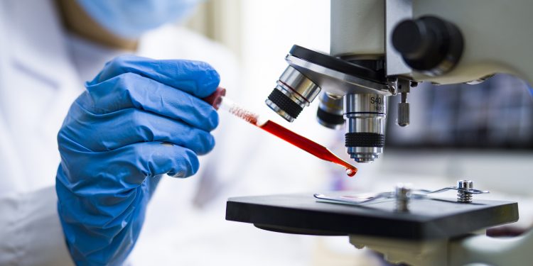 Scientist working with blood sample in laboratory