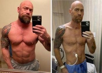 FOTO/ Pas 6 javësh në intubim nga COVID-19, shihni ndryshimin drastik që i ka ndodhur infermierit