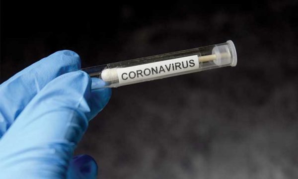 Kosovë/ 23 raste të reja me koronavirus, shërohen 22 pacientë të tjerë
