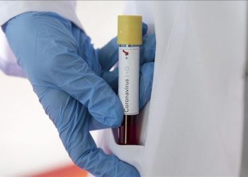 Farmacisti në Fier del pozitiv me koronavirus/ U infektua nga gruaja shtatzënë që u prek nga virusi pak ditë më parë