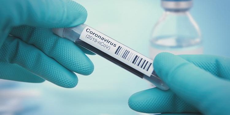 Detail of coronavirus test sample