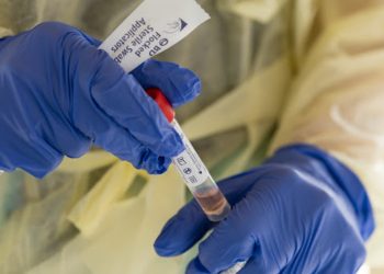 Koronavirusi futet edhe në Gjykatën e Apelit Shkodër, infektohet punonjësja