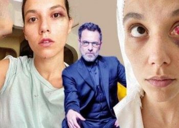 VIDEO+FOTO/ Rreh brutalisht të dashurën, përfundon në polici aktori i “Sulejmanit të Madhërishëm”