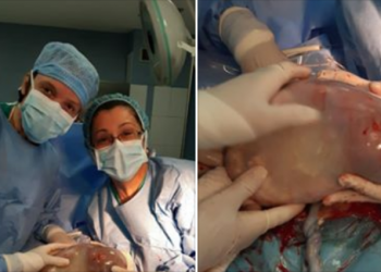 FOTO/ Rrast i veçantë dhe emocionues, tek “Koço Gliozheni” lind fëmija me këmishë