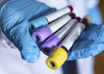 Mbyllet shërbimi ADISA në Fier, shkak infektimi me COVID i bashkëshortes të një punonjësi/ 12 raste vetëm në Kadastër