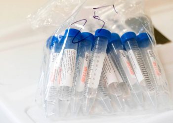 Kolonjë, nëna infekton djalin me koronavirus