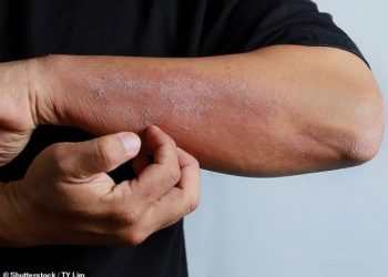 Skuqja dhe irritimi i lëkurës, simptomë e prekjes nga COVID-19