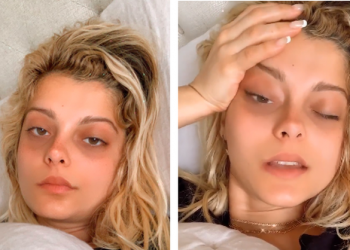 Vështirësi në frymëmarrje dhe dhimbje, Bebe Rexha do t’i nënshtrohet operacionit