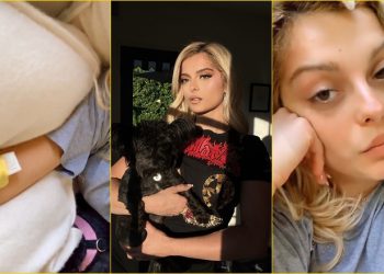 FOTO/ Me rrathë të zinj poshtë syve, Bebe Rexha tregon betejën me infeksionin: Dua mamin