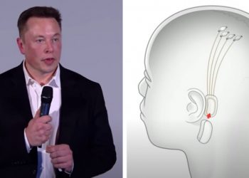 Elon Musk prezanton çipin sa një monedhë: Instalohet në tru dhe mund të shërojë verbërinë, paralizën apo parkinsonin