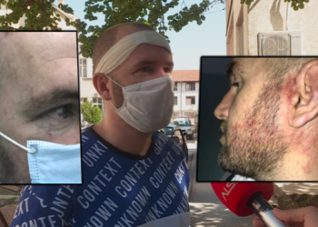 Polici serb rreh keq të riun shqiptar, dëshmia e 31-vjeçarit: Nuk njoha as fqinjët nga plagët e marra