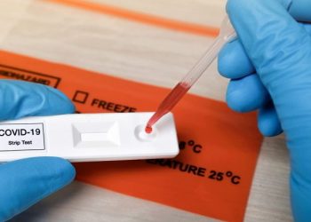 Licencohen edhe 10 laboratorë privatë për kryerjen e testimeve për COVID-19