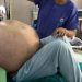 Mbi 180 minuta operacion, hiqet me sukses tumori më i madh ovarian