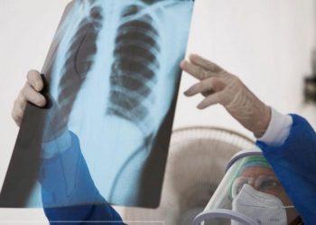 STUDIMI/ Ja superkompjuteri që analizoi COVID-19