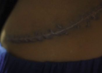 INVESTIGIMI i BBC/ Të bësh kumar me jetën, tmerri me shitjen e organeve