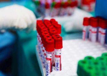 Berat, të infektuar me vovid-19, mësues, polic, edukatore dhe specialistë të ndryshëm