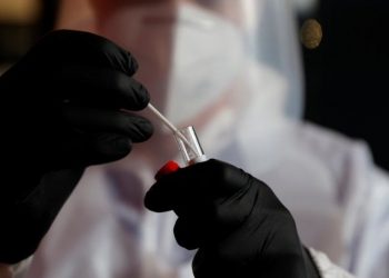 Varianti i ri i koronavirusit i “zë derën” Francës