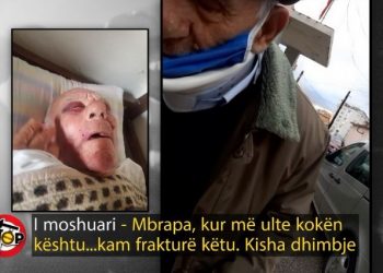 “Më rrahu si gomari në duhan”, djali dhunon barbarisht të atin 92-vjeçar, gjykata e lë të lirë