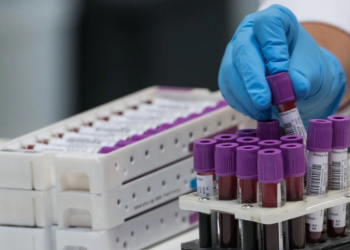 Në Kosovë nis trajtimi i pacientëve me COVID-19 me plazmën e gjakut