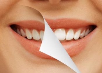 Çfarë nuk duhet të bëni, nëse doni të keni dhëmbë të bardhë?