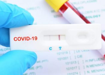 Koronavirusi në M.Veriut/ 8 viktima dhe 554 të infektuar në 24 orët e fundit