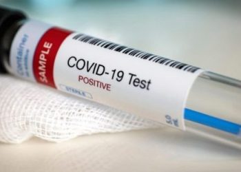 COVID/ Konfirmohen rastet e para të ri-infektimeve në vend, 6 muaj pasi ishin infektuar herën e parë