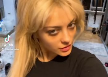 FOTOT/  Bebe Raxha:“Jam shumë e lodhur nga Photoshop, ja difektet e mia”