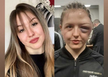 Si u shpërfytyrua sportistja bukuroshe gjatë ndeshjes së boksit (FOTO)