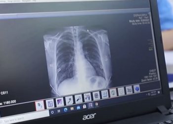 “1 cigare e shkurton jetën e duhanpirësit me 11 minuta”