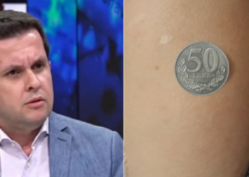 Monedhat ‘ngjisin’ tek krahu nga vaksina? Epidemiologu shuan zërat: Është për shkak të djersës e jo për faj të…