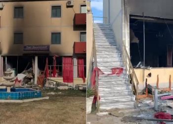 Shpërthimi në Velipojë/ Manastirliu viziton në spital nënën e tre fëmijët e plagosur, mjekët: Prognoza e rëndë