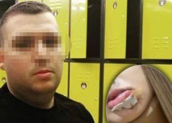 Ky është Denisi, 32-vjeçari që grushton vajzat natën në Tiranë, ka probleme të shëndetit mendor