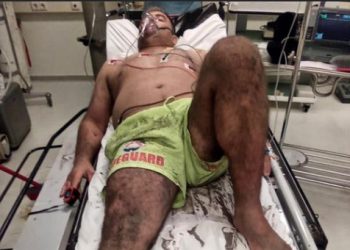 FOTO/ Një ‘hero’ në det, vrojtuesi shpëton nënë e bir nga mbytja në Spille, por vetë përfundon rëndë në spital