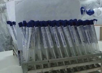 Mbi 1.5 milionë viktima nga koronavirusi në Amerikën Latine