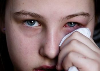 “Në Shqipëri po qarkullon ‘gripi i syrit’ tek fëmijët”/ Mjekët japin alarmin për të gjithë prindërit
