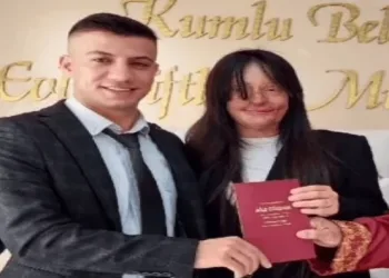 FOTOT/ I hodhi acid në fytyrë, 20-vjeçarja martohet me agresorin që e shpërfytyroi