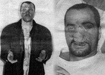 25 vite më parë/ Kush e rrahu Edi Ramën në ’97? Dëshmia: Donin të më vrisnin?! Cilët ishin operativët e SHIK-ut që bën për spital kryeministrin