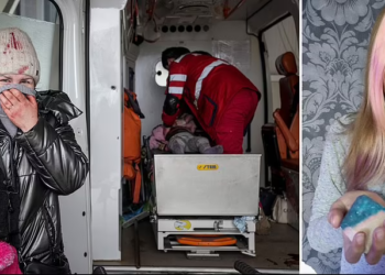 FOTO/ “Tregojni Putinit sytë e këtij fëmije”. Mjekët luftojnë për ta shpëtuar 6-vjeçaren e plagosur nga bombardimet, por…