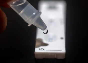 Studimi: Ekspozimi ndaj një teshtime është mjaftueshëm për t’u infektuar me COVID